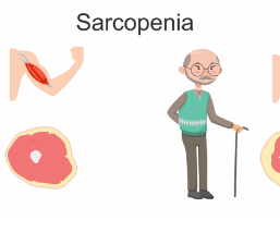 About Sarcopenia and Effective Prevention Methods