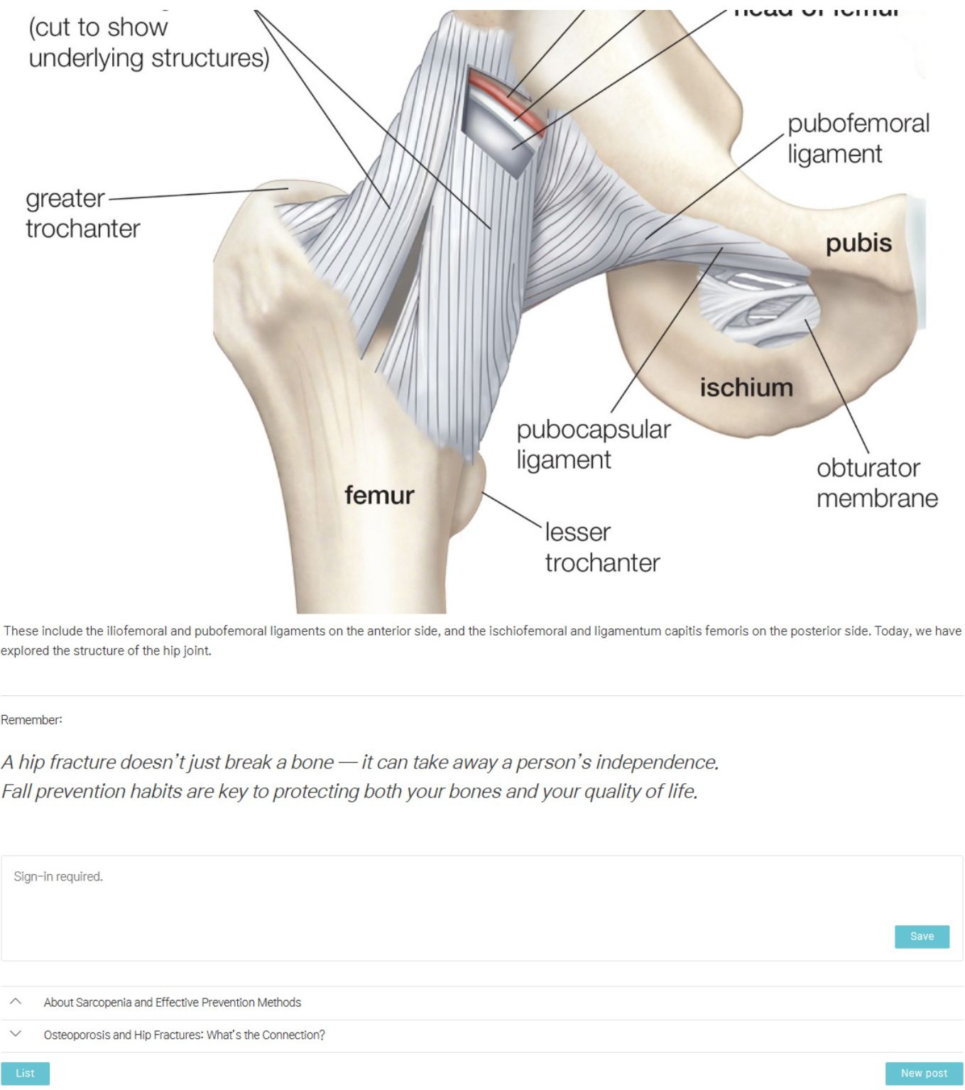 Diagram of the hip joint showing bones and surrounding ligaments